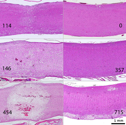 Spinal cord parasagittal sections: histopathological changes